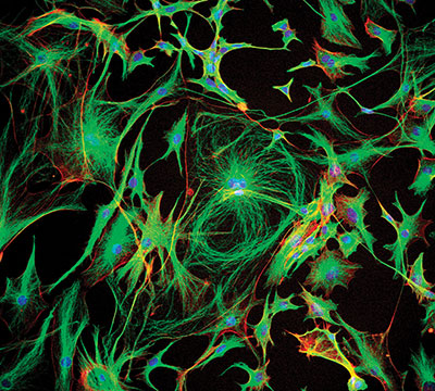 Confocal light micrograph of astrocytes from the brain of a mouse. Flourescent markers have been used to highlight structures in the cells.