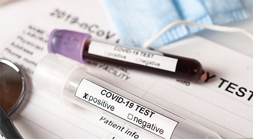 COVID-19 blood test