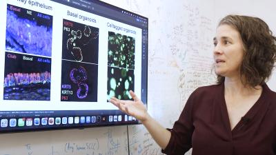 Trudy Oliver, PhD, shows images of cells involved in small cell lung cancer