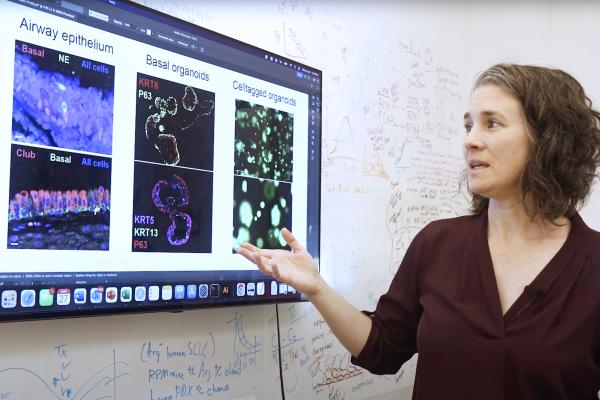 Trudy Oliver, PhD, shows images of cells involved in small cell lung cancer