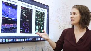 Trudy Oliver, PhD, shows images of cells involved in small cell lung cancer