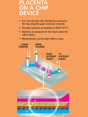 a chart describing the Placenta on a chip device
