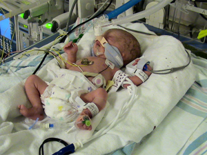 Addie Spancake as a newborn in the NICU