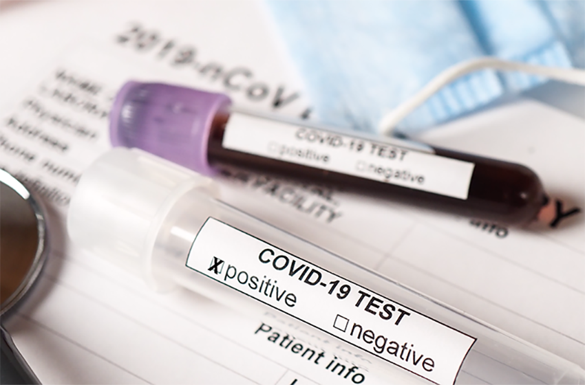 COVID-19 blood test